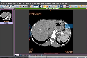 Sante DICOM Editor 医学影像编辑器 060662