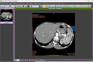 Sante DICOM Viewer Pro 医学影像浏览器 060663