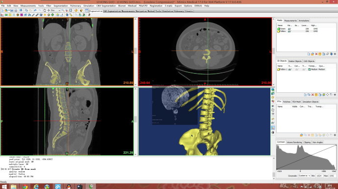 Materialise Mimics Innovation Suite Medical Resarch 工具套装 010663
