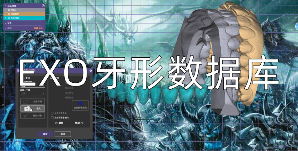 EXO牙形数据库马龙桥数据库牙齿数据库exocad010324