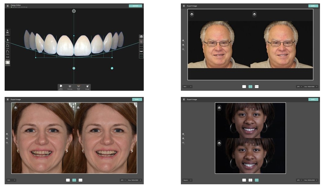 SmileDesignerPro v3.4.3 一机一码授权版数码微笑设计Smile Designer Pro牙科医生专业需求060690