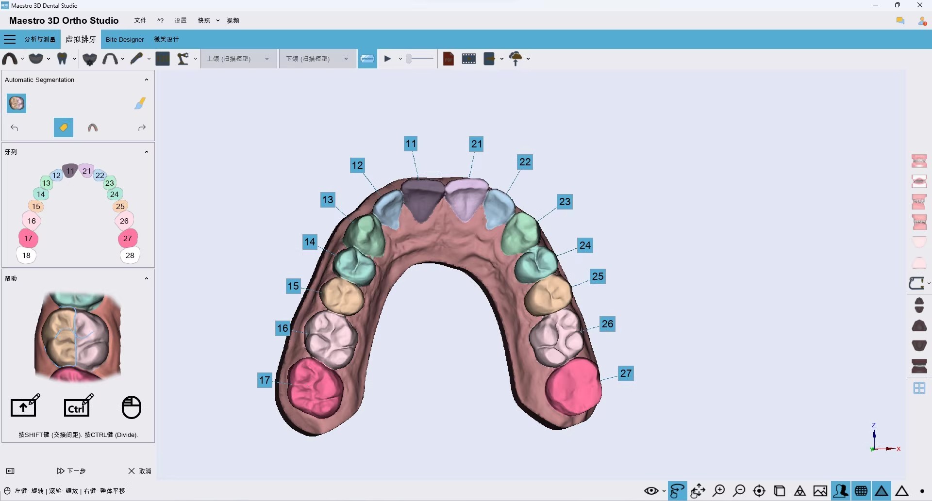 Maestro 3D Dental Studio v6.0 正畸隐形矫正设计软件Maestro 3D V6.0 Dental Studio 060223