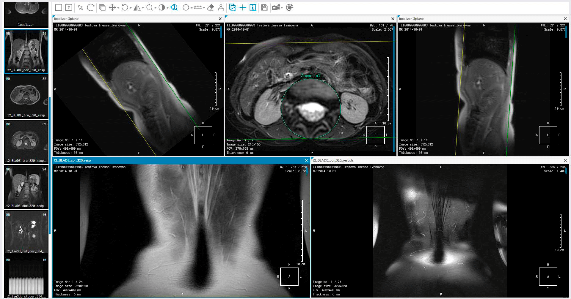 Inobitec DICOM Viewer Pro 内窥镜检查高级3D重建工具060525