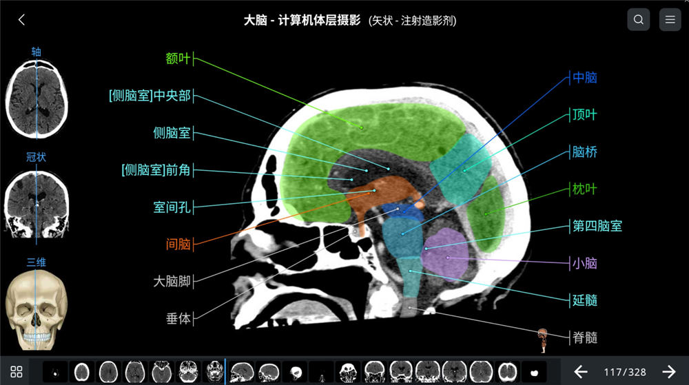 e-Anatomy影像解剖软件e-anatomy断层影像解剖软件eanatomy永久中文版人体断层影像解剖图谱app工具060537