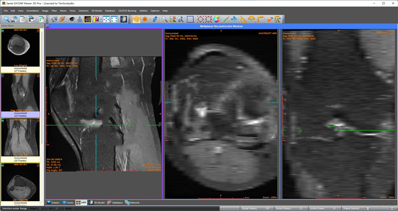 Sante DICOM Viewer 3D Pro v4.9.4 DICOM医学影像浏览器060572
