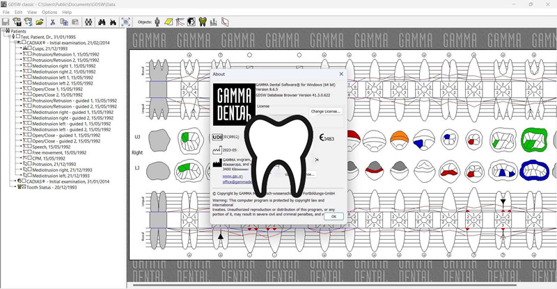 Gamma dental 8.8.3 注册版伽玛牙科设计制造及编程医疗设备与软件工具060233
