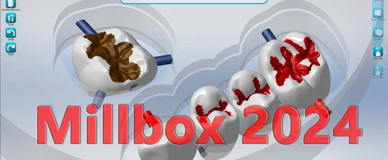 CIMsystem MillBox UP3D 2024 牙科制造数字化工作流程软件工具060238