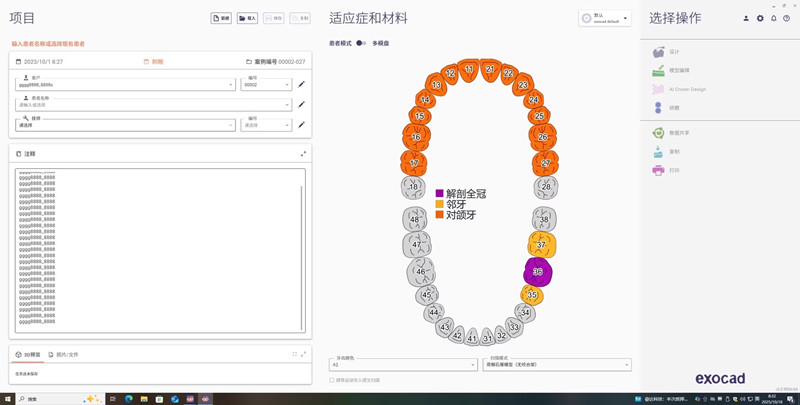 Exo3.2 9037一机一码注册版 Exocad DentalCAD 数字化牙科Exocad DentalCAD 3.2 Elefsina FDA 9037 AI 