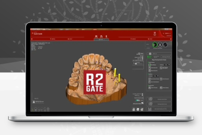 R2GATE 2.2.0 2024 牙科种植规划软件