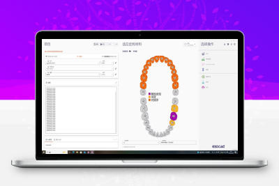 Exo3.2 9036一机一码注册版 Exocad DentalCAD 数字化牙科exoCAD