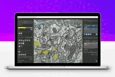Dragonfly 2025.1 加密狗版多模态图像数据多维显示转换测量工具三维图像专业处理软件